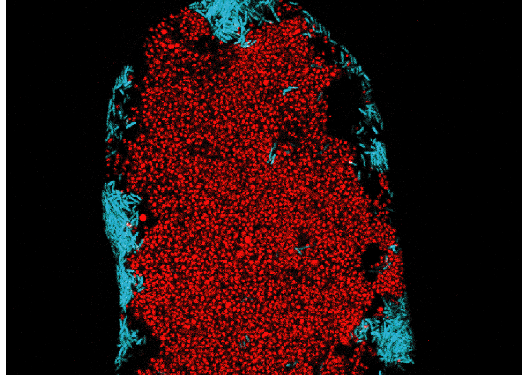 P. aeruginosa densely colonizing an intestinal crypt, flanked by B. fragilis — confocal cross-section