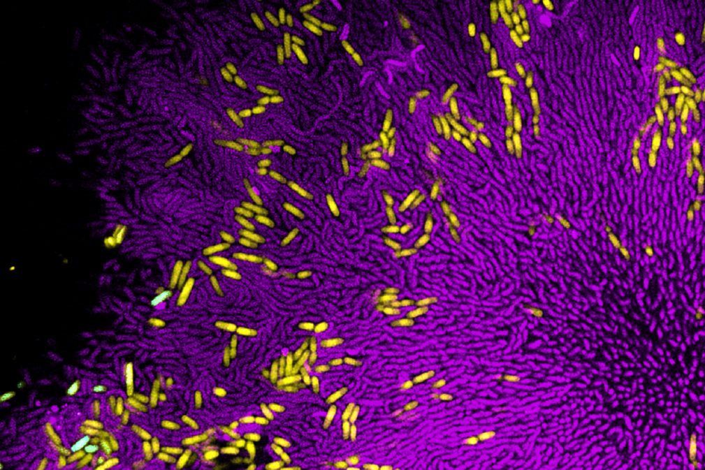 Vibrio cholerae biofilm (purple) surrounding E. coli clusters (yellow), protecting from bacteriophage predation — confocal microscopy